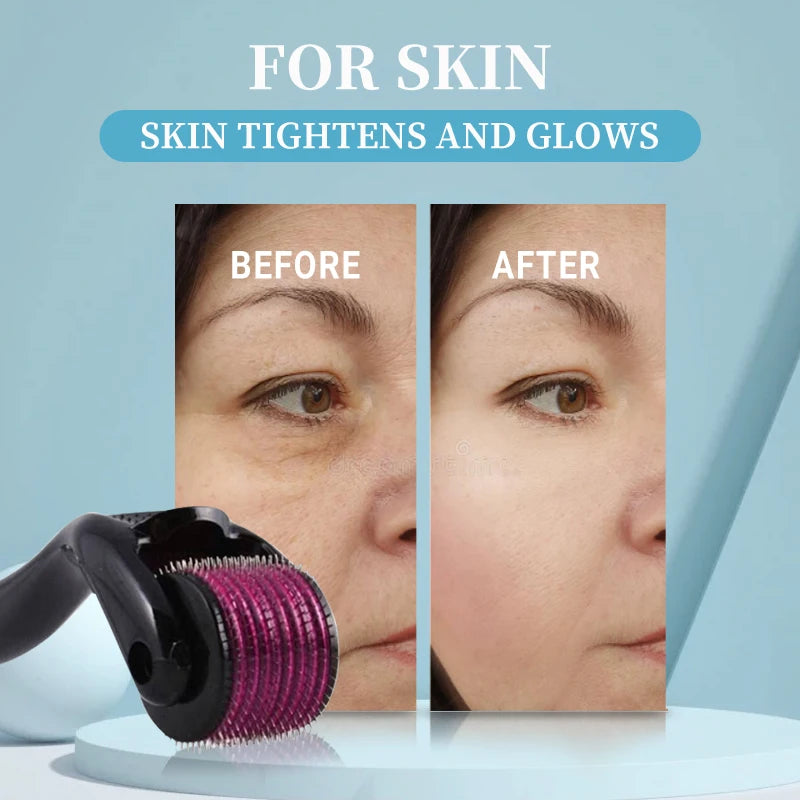 Titanium Derma Roller