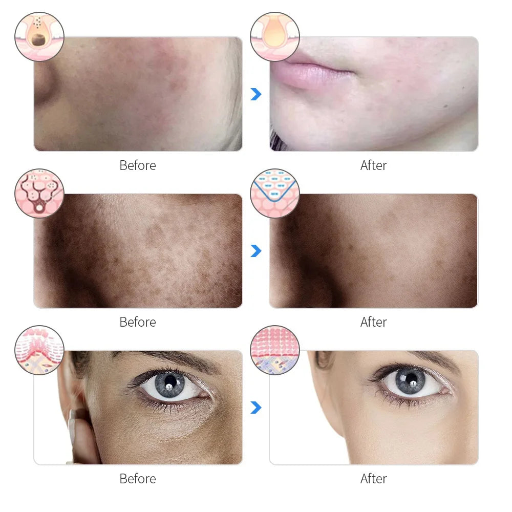 7-Color LED Facial Mask