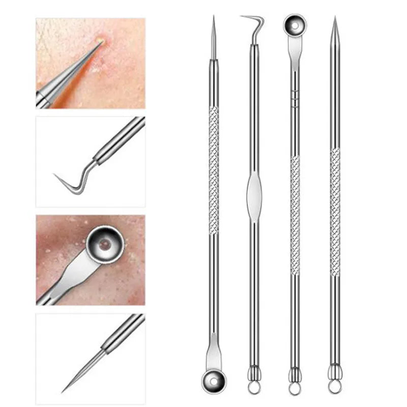 Acne Extractor Tool Kit