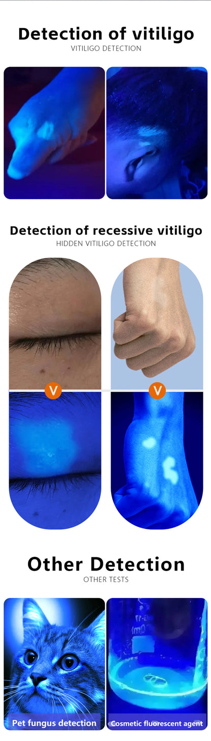 UV Skin Analyzer Lamp