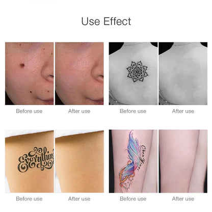 Pico Laser Skin Pen