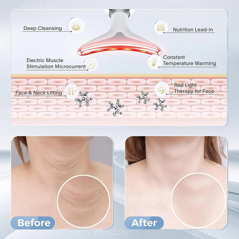 Lift & Tighten Facial Device