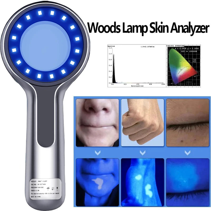 UV Skin Analyzer Lamp